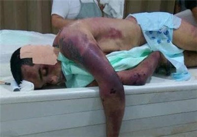 Усиление пыток над заключенными в Бахрейне